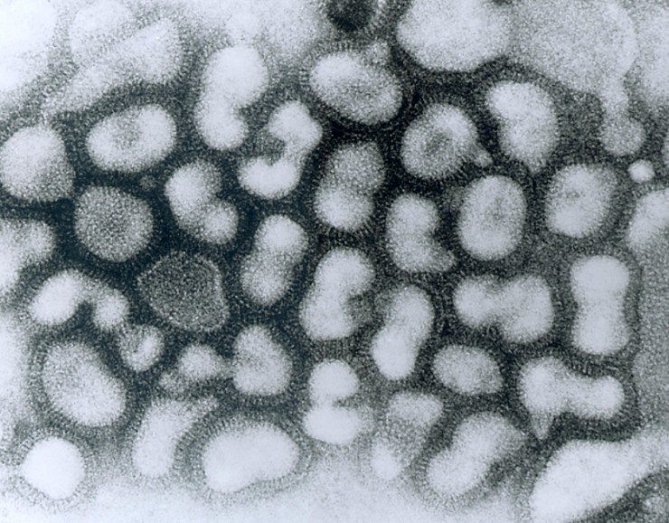 Вирус птичьего гриппа. Микрофотография
