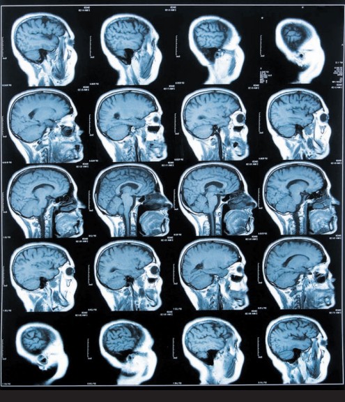 Томография мозга исправно служит для исследования нервной системы