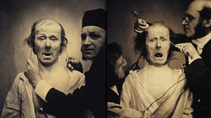 Дюшен де Булонь демонстрирует, как можно менять выражение лица с помощью электричества