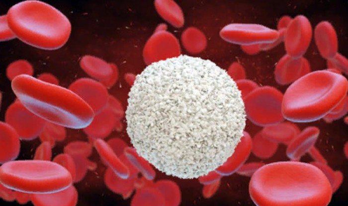 Белые кровяные клетки (в центре), окруженные красными кровяными клетками