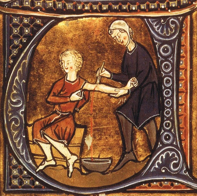 Процедура кровопускания в Средние века в Европе
