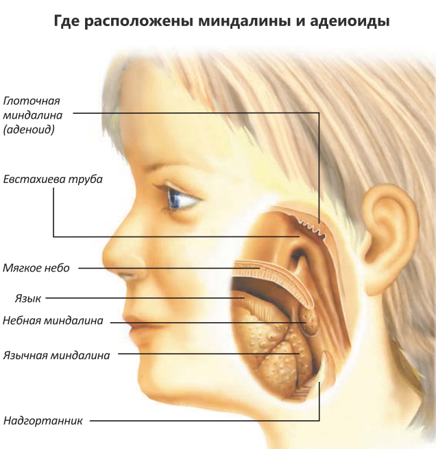 Где аденоиды у ребенка. Миндалины аденоиды анатомия. Строение носа аденоидит. Аденоиды у детей строение.